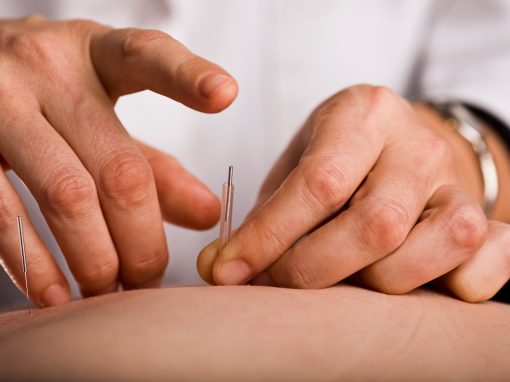 Is Acupuncture safe?